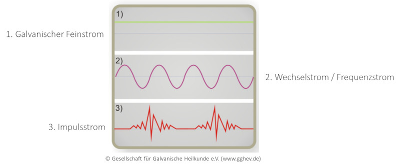 galvanischer-feinstrom-wechselstrom-unterschiede-impulsstrom-infografik